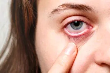 چشم هم سکته می‌کند؟
