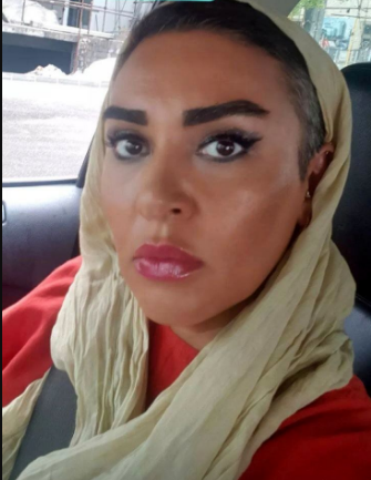 تغییرات ترسناک چهره زیبا بروفه در این عکس عجیب+عکس