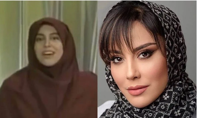 تغییرچهره آشا محرابی قبل و بعد از عمل های زیبایی+عکس