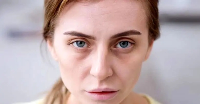 7 نشانه‌ پوستی که بیماری جدی را آشکار می‌کنند