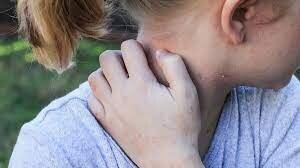 7 نشانه‌ی پوستی که خبر از بیماری جدی می‌دهند